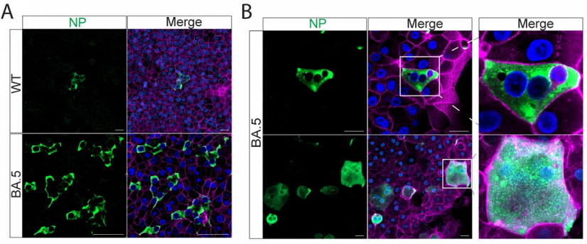 Nasal organoids were inoculated with SARS-CoV-2 WT and BA.5 at 0.01 MOI. Virus-infected (Nucleocapsid, NP+) cells in BA.5-infected nasal organoids were remarkably more abundant than those in WT-infected organoids (Diagram A). NP+ multi-nucleated syncytia with typical morphology were readily discernible in BA.5-infected monolayers of the nasal organoids (Diagram B).

 